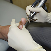 Custom orthotics fitting consultation at Victoria Park Podiatry